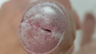Extreme Burning Sensation Makes the Glans Foam with Arousal.