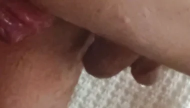 Prolapse and Urine