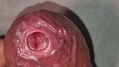 Close up on Phimosis Large Cock, so Hot!