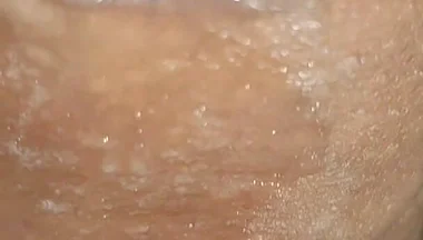 Scrotal Phimosis Results in an Extremely Hot Orgasm.