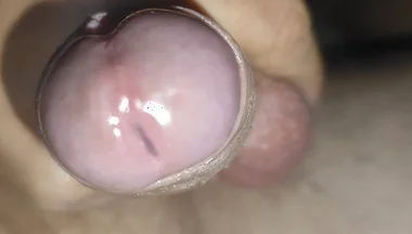 Scrotal Phimosis Results in an Extremely Hot Orgasm.