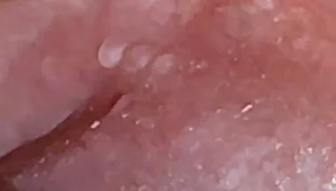 Super Daddy Enlarged Hole Pulsing with Horniness.