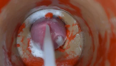 Insemination - Internal Camera Captures Deep Male Ejaculation