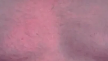 Brust Raus Nippel