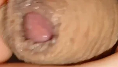 Cumshot of the Largest Phimosis Foreskin in the World.