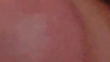 Immense Phimosis Being Extracted Cum and Précum.