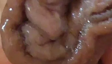 Large Foreskin and Balls in Striking Close-up.