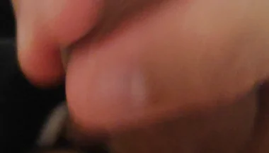 Immense Phimosis Being Extracted Cum and Précum.
