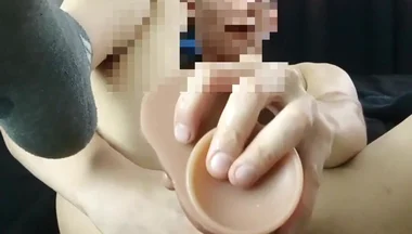 Anal Gaping