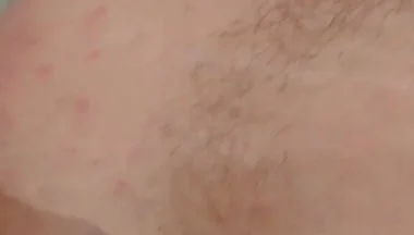 Masturbation