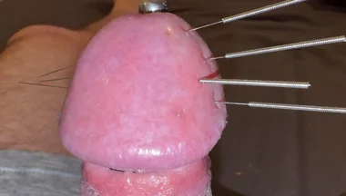 Needles Through the Thick, Hard Glans, Mega Orgasm