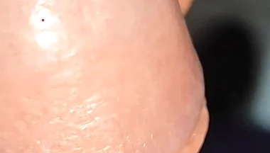 Extreme Application to the Syringe Inside the Glans!!