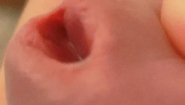 Amazing Closeup of the Widened Hole!!