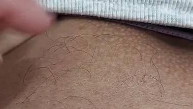 The Hair on My Penis - Led Hair Removal
