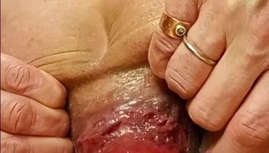 Live Anal Dilation Exercise on Cam to Make You Cum
