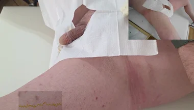 16 French Foley Insertion