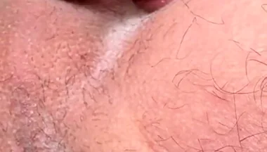 Asshole in Your Face