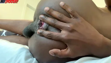 Super Stretchy Sphincter (buttlip Asshole Rim) - Starring Dj Buttpussy