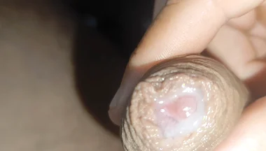 I Have the Largest Ejaculating Phimosis in the World!!