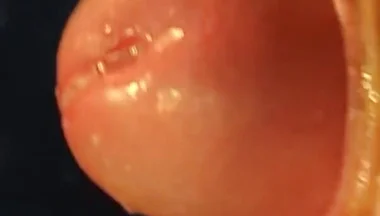 Juicy Close up