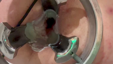 Pouring Hot Candle Wax Into Ass