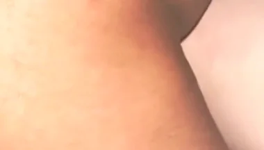 Smooth Skin