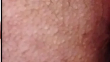 Split-screen Twitching Asshole Dripping with Massive Cum Load