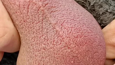 Big Uncut Cock Edging and Cumming, Outdoor Onesie Wank for the Neighbours - Rockardglans