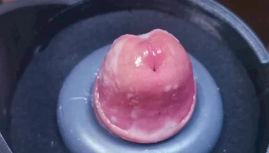 Penis Machine with a New Attachment