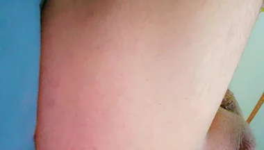 Widening the Ass Opening for Easy Orgasm.