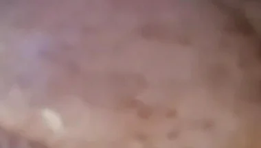 Extreme Fillings Inside My Siliconemeat
