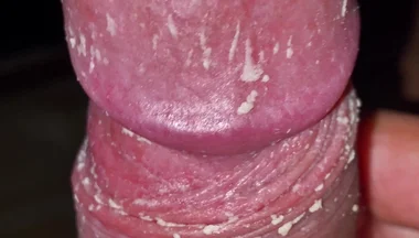 Checking My Dirty Dick