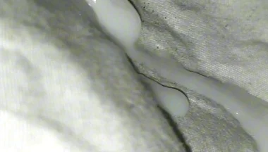 Huge Sperms Out of His Penis, an Young Boy