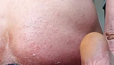 Fireworks of Sperm After a Major Dilation
