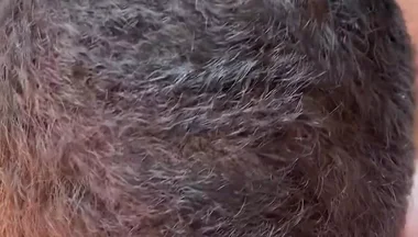 More Sucking