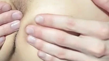 I'm Fucking My Prolapsed Anal Prolapse with My Hand