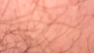 Close up Hairy Hole