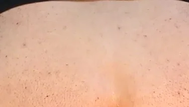 He Enjoys Sucking on His Anal Prolapse