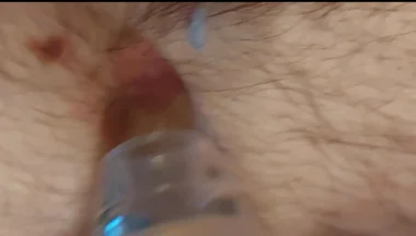 A Close-up Shot of My Belly Button as I Play with It