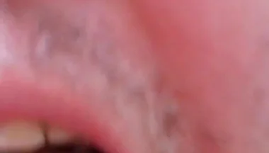 Camera Blunder in the Attempt at Facial Insemination