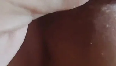 Application of Instant Phimosis Remover.