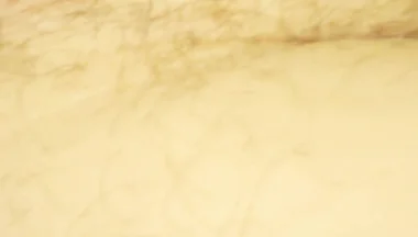 Close up of My Hole