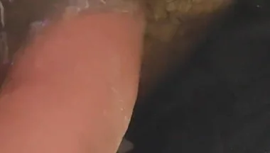 Uncircumcised Phimosis Has the First Ejaculation.