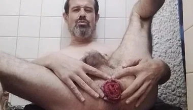 My Prolapse April 2026