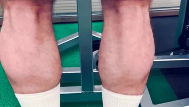 My Legs