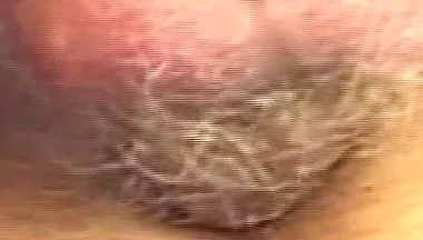 Outdoor Anal Stretching with Dripping Cocks and Gaping Holes