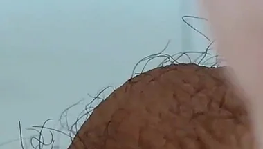 Extreme Open Hole Leaves the Glans Exposed.