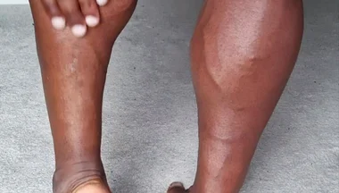 For My Feet Lovers