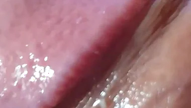 Strange Lumpy Cock with a Gigantic Head.