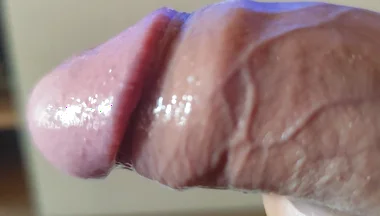 Strange Lumpy Cock with a Gigantic Head.